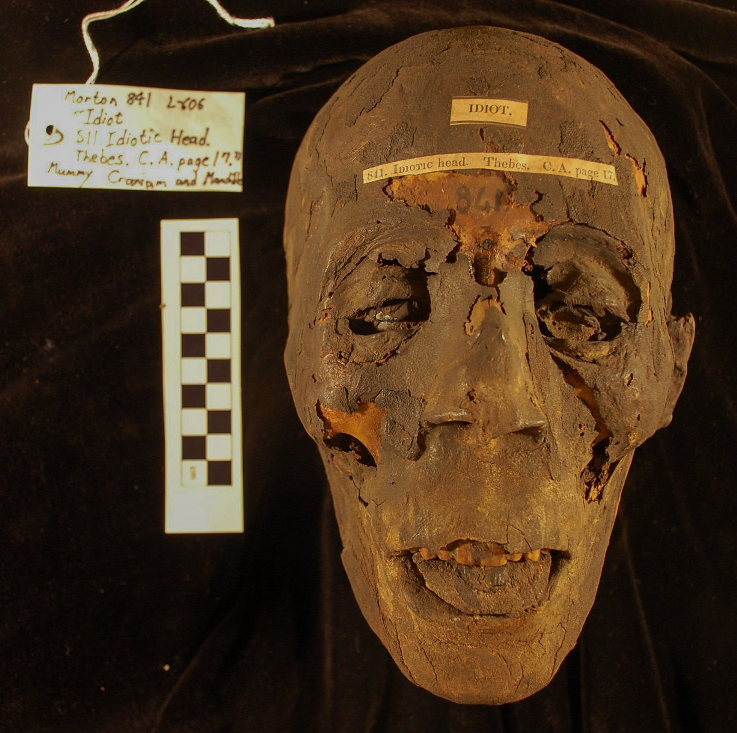 Figure 3: Mummified Egyptian crania #0841 of the Morton Cranial Collection, Penn Museum Open Research Scan Archive (ORSA).