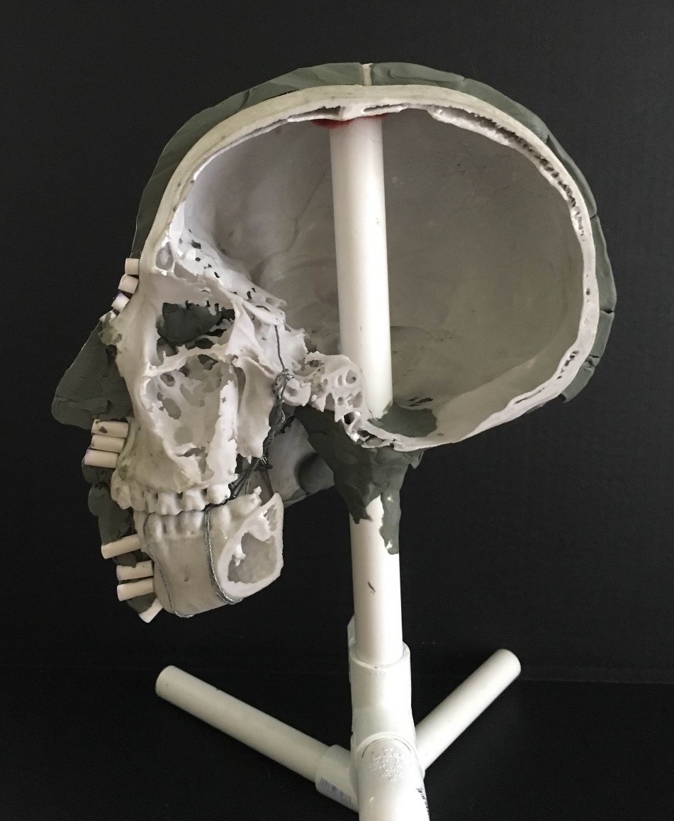 Figure 1: Partial forensic facial approximation of a mummified skull showing tissue depth. 3D print created from CT scans from the Morton Cranial Collection, University of Pennsylvania Museum of Archaeology and Anthropology (Penn Museum). Approximation and photograph by Elizabeth Bouton, 2017.